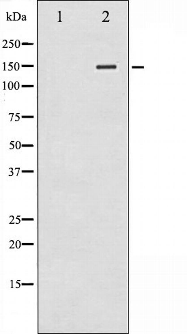 Phospho-iNOS (Tyr151) Antibody in Western Blot (WB)