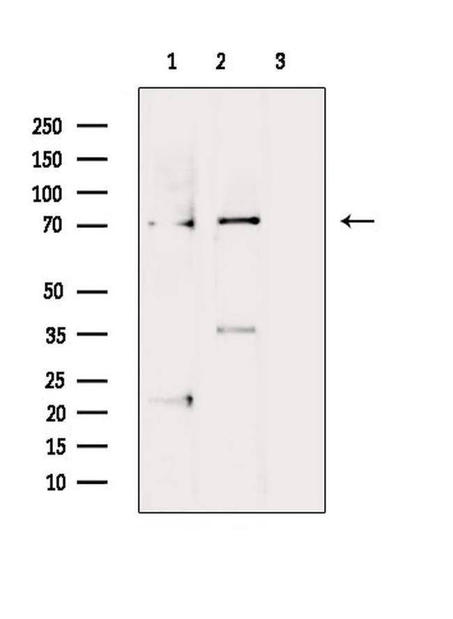 Phospho-LIMK1 (Thr508) Antibody in Western Blot (WB)