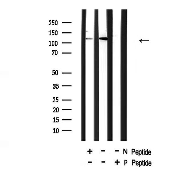 Phospho-NFkB p50/p105 (Ser903) Antibody in Western Blot (WB)