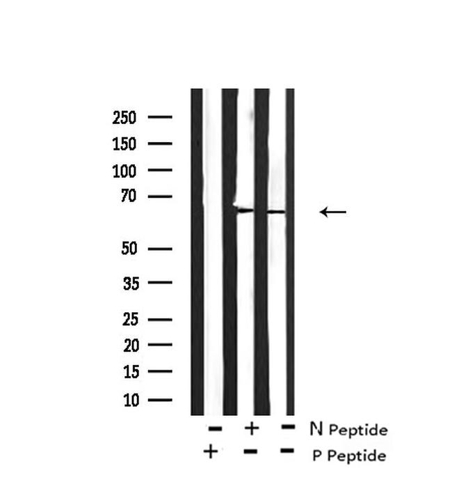 Phospho-LKB1 (Ser334) Antibody in Western Blot (WB)