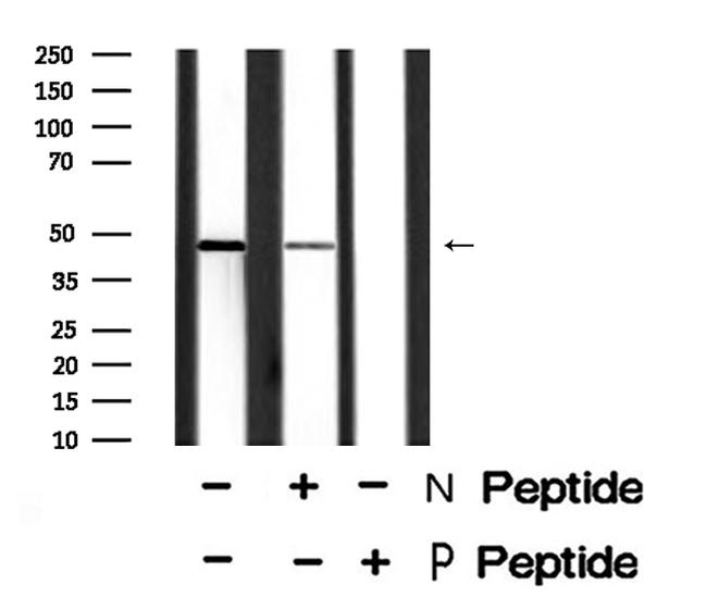 Phospho-Bcl-3 (Ser402) Antibody in Western Blot (WB)