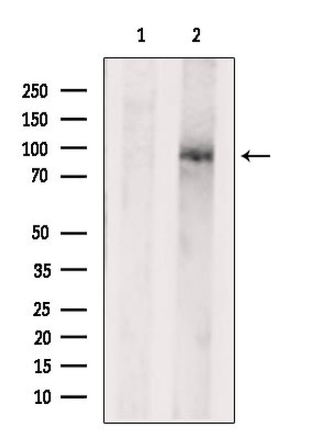 SEMA3A Antibody in Western Blot (WB)