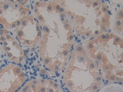 CARD9 Antibody in Immunohistochemistry (Paraffin) (IHC (P))
