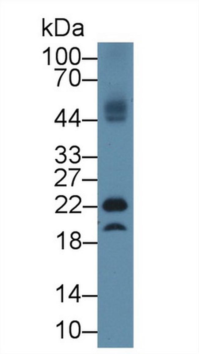 GPX4 Antibody in Western Blot (WB)