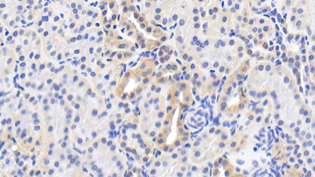HSP60 Antibody in Immunohistochemistry (Paraffin) (IHC (P))