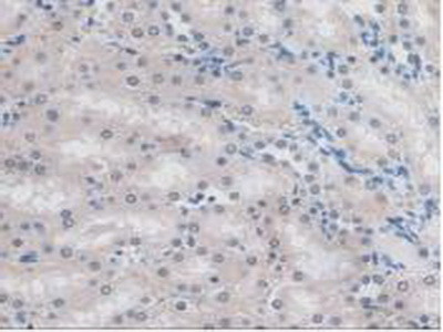 MYO1D Antibody in Immunohistochemistry (Paraffin) (IHC (P))