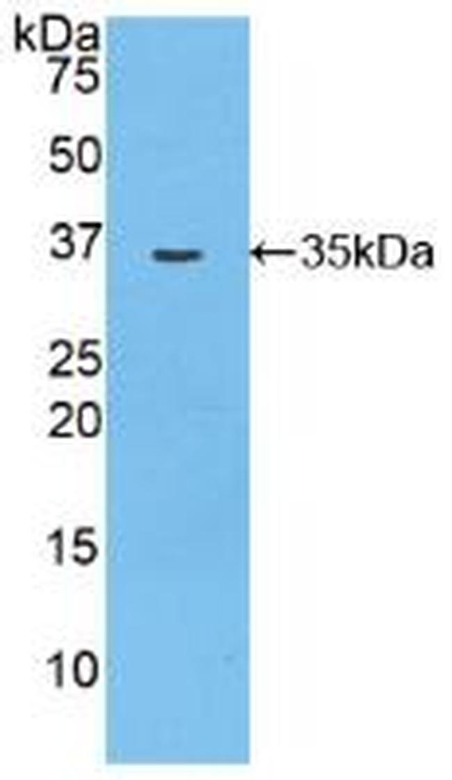 MYO1D Antibody in Western Blot (WB)