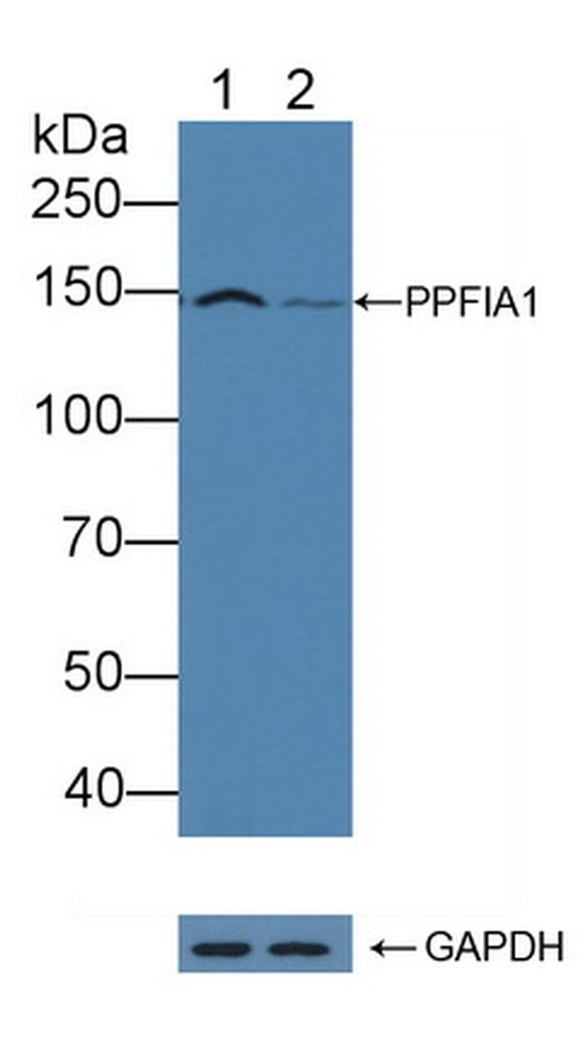 PPFIA1 Antibody in Western Blot (WB)