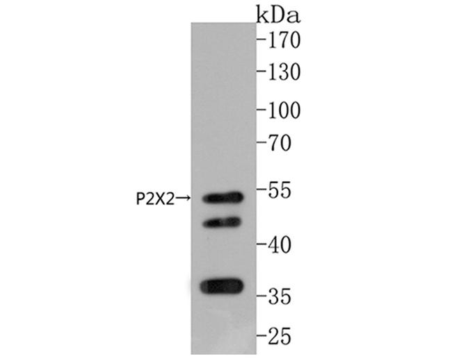 P2X2 Antibody in Western Blot (WB)