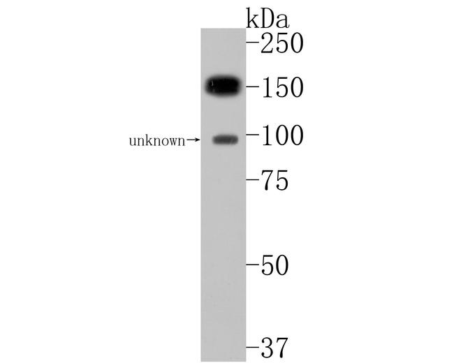PLCB1 Antibody in Western Blot (WB)