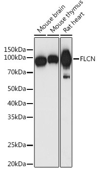 Folliculin Antibody in Western Blot (WB)