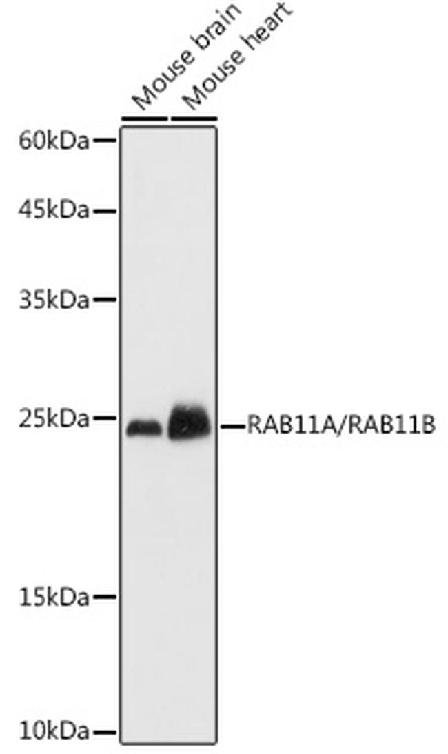 RAB11A/RAB11B Antibody in Western Blot (WB)
