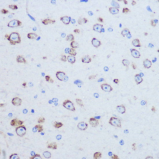 DAP5 Antibody in Immunohistochemistry (Paraffin) (IHC (P))