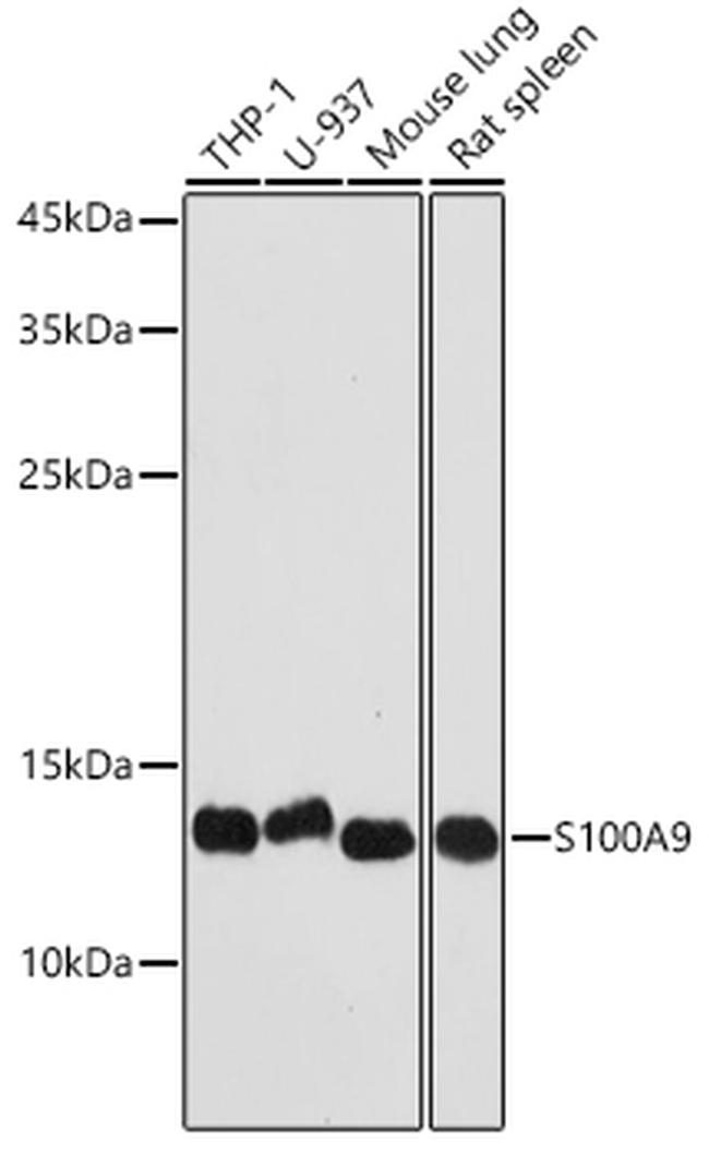 S100A9 Antibody in Western Blot (WB)