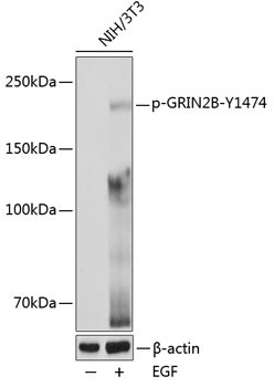 Phospho-NMDAR2B (Tyr1474) Antibody in Western Blot (WB)