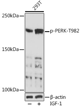 Phospho-PERK (Thr982) Antibody in Western Blot (WB)
