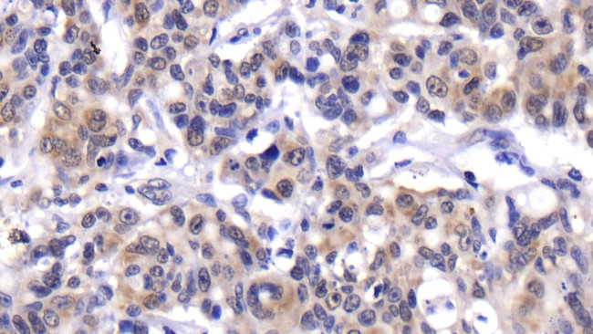 CXCL13 Antibody in Immunohistochemistry (Paraffin) (IHC (P))
