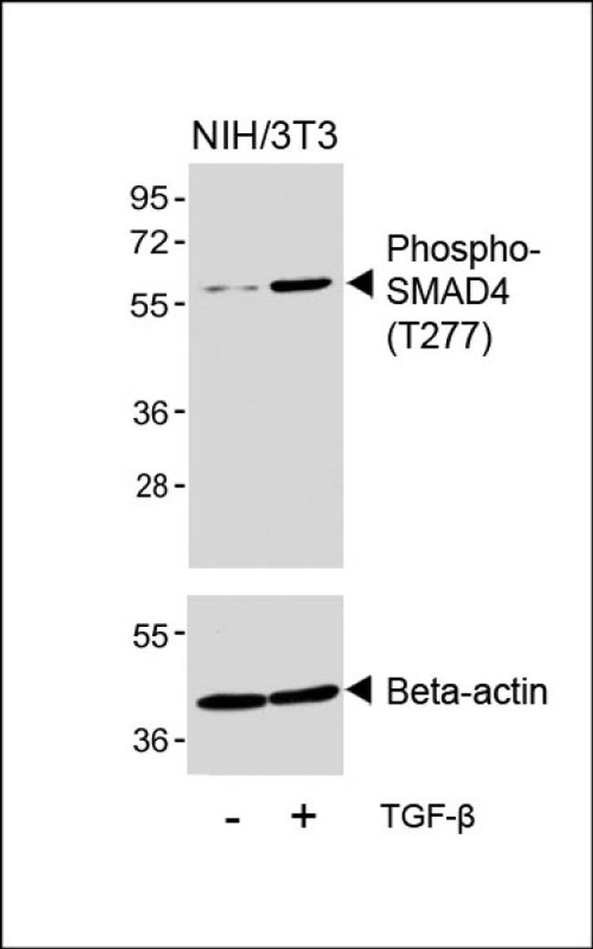 Phospho-SMAD4 (Thr277) Antibody in Western Blot (WB)