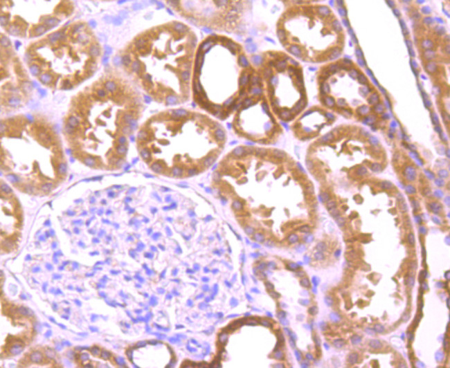 NSUN4 Antibody in Immunohistochemistry (Paraffin) (IHC (P))