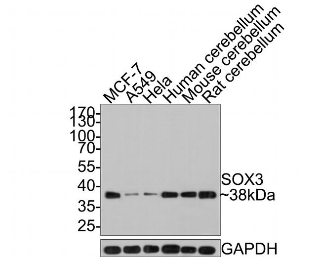 SOX3 Antibody in Western Blot (WB)