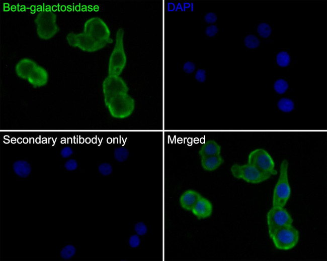 beta Galactosidase Antibody in Immunocytochemistry (ICC/IF)