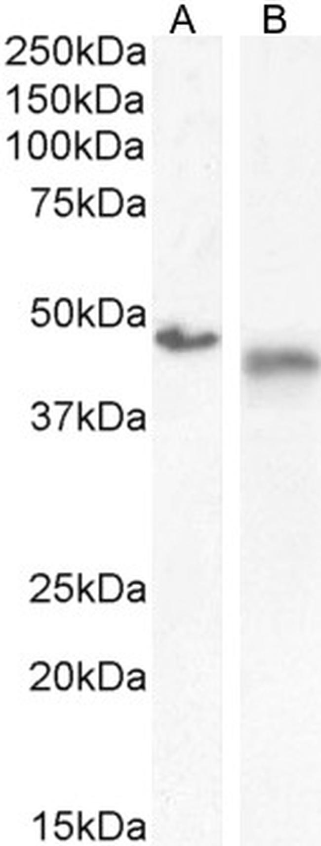 IL1R2 Antibody in Western Blot (WB)