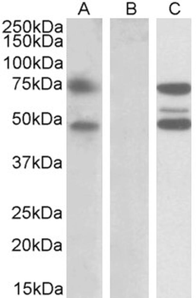 ASNSD1 Antibody in Western Blot (WB)