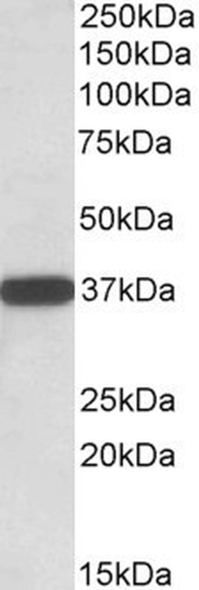 CYB5R3 Antibody in Western Blot (WB)