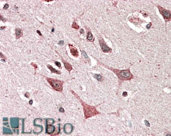 MOB4 Antibody in Immunohistochemistry (Paraffin) (IHC (P))