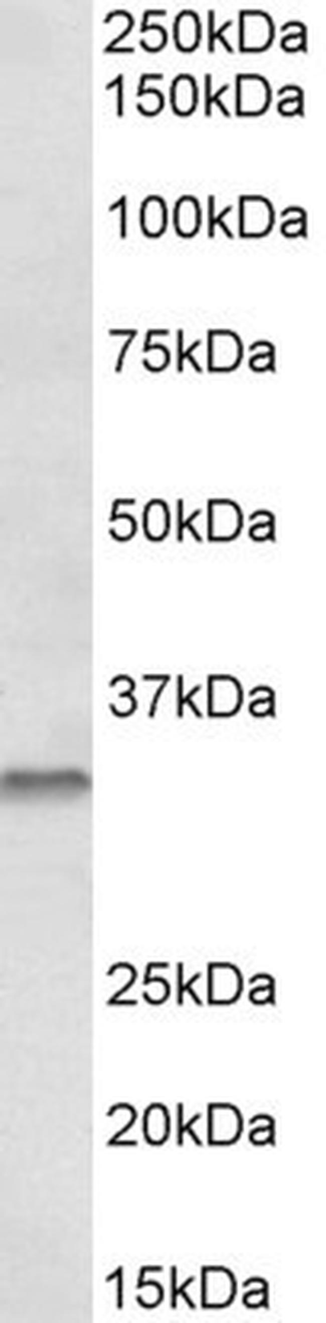 Caspase 6 Antibody in Western Blot (WB)