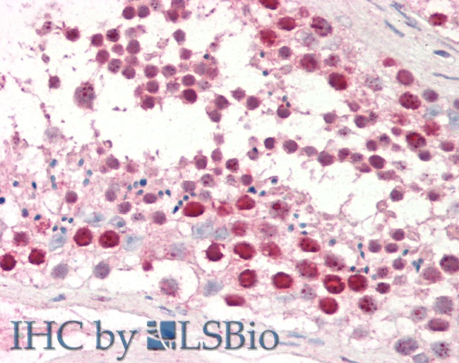DUT Antibody in Immunohistochemistry (Paraffin) (IHC (P))