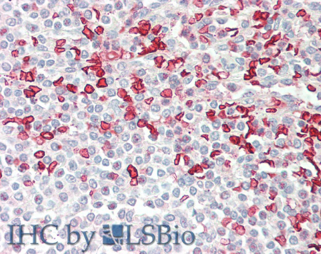 HMBS Antibody in Immunohistochemistry (Paraffin) (IHC (P))