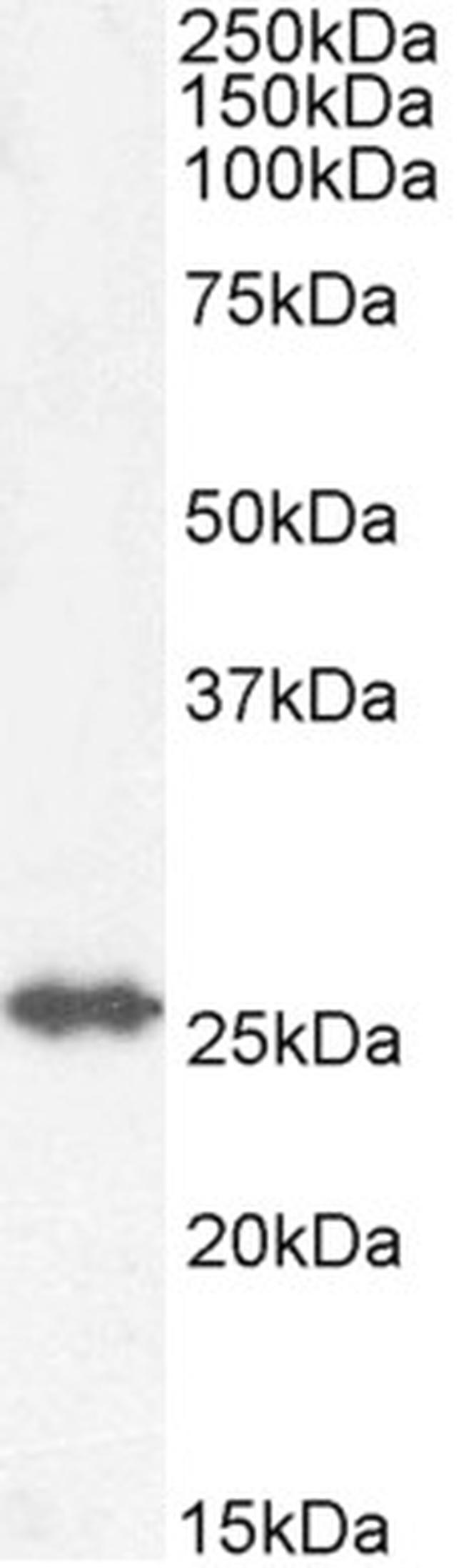 GSTM4 Antibody in Western Blot (WB)