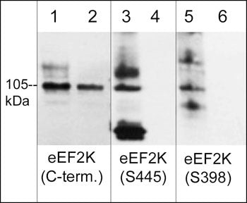 Phospho-EEF2K (Ser445) Antibody in Western Blot (WB)