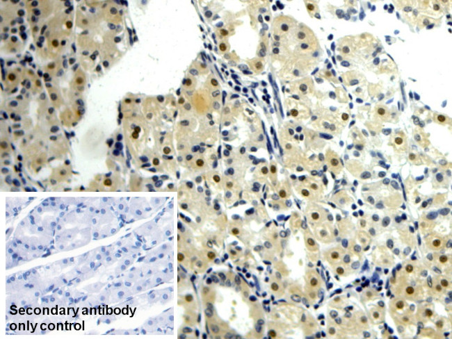 NAMPT Antibody in Immunohistochemistry (Paraffin) (IHC (P))