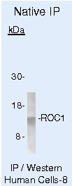 ROC1 Antibody in Immunoprecipitation (IP)