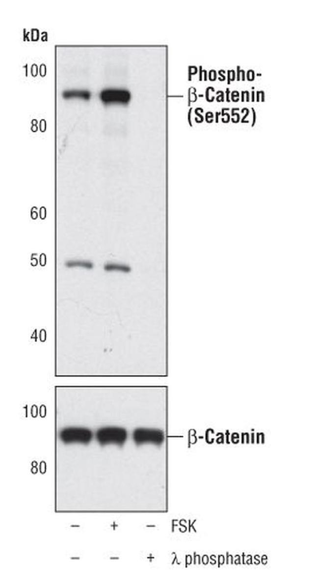 Phospho-beta Catenin (Ser552) Antibody