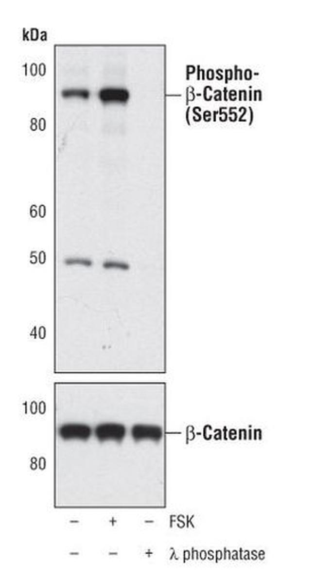 Phospho-beta Catenin (Ser552) Antibody in Western Blot (WB)