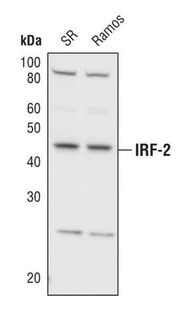 IRF2 Antibody in Western Blot (WB)