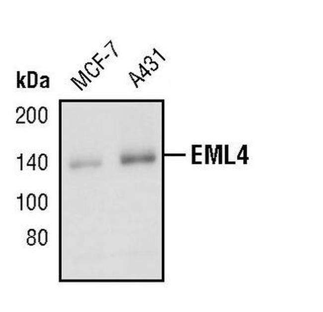 EML4 Antibody in Western Blot (WB)