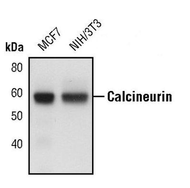 Calcineurin A Antibody in Western Blot (WB)