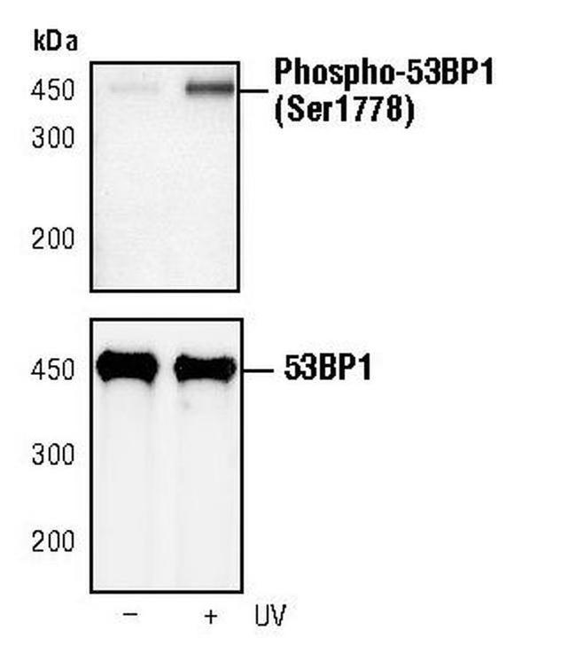 Phospho-53BP1 (Ser1778) Antibody