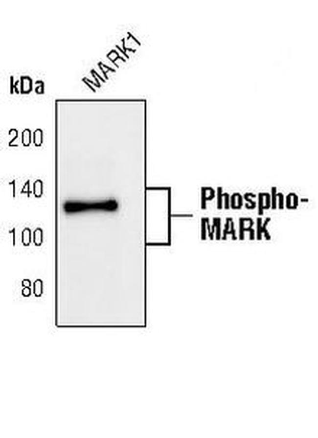 Phospho-MARK1/MARK2/MARK3 (Thr215, Thr208, Thr234) Antibody in Western Blot (WB)