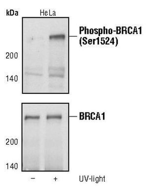 Phospho-BRCA1 (Ser1524) Antibody in Western Blot (WB)