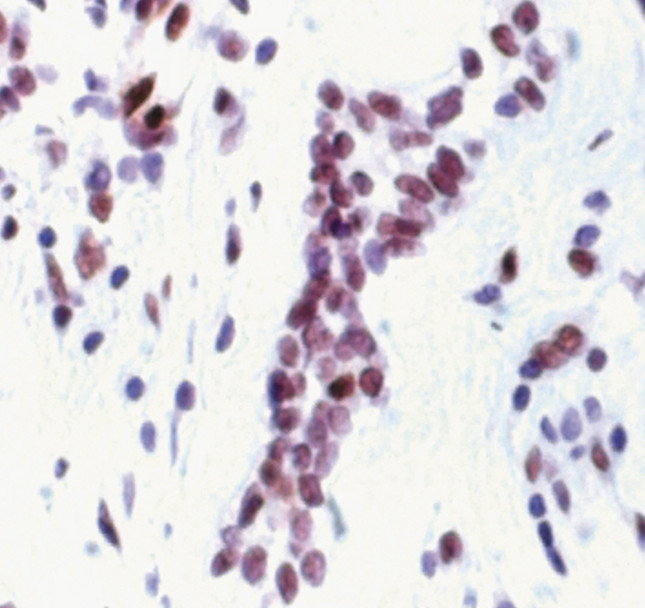 Phospho-MSK1 (Thr581) Antibody in Immunohistochemistry (Paraffin) (IHC (P))
