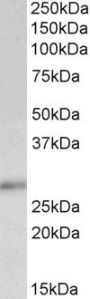 p27 Kip1 Antibody in Western Blot (WB)