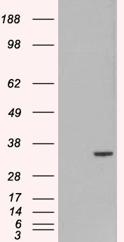 ORC6 Antibody in Western Blot (WB)