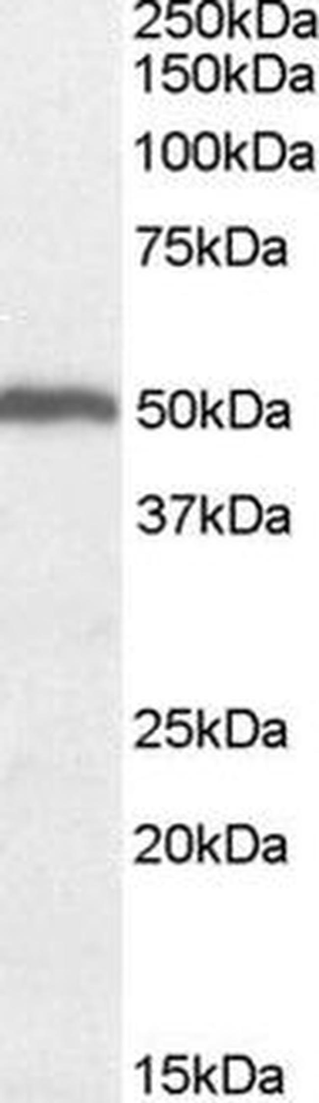 ORC4 Antibody in Western Blot (WB)