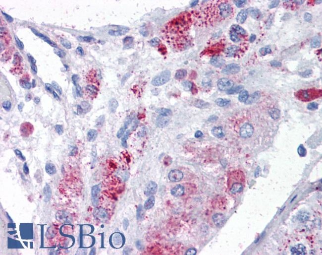 MTA1 Antibody in Immunohistochemistry (Paraffin) (IHC (P))