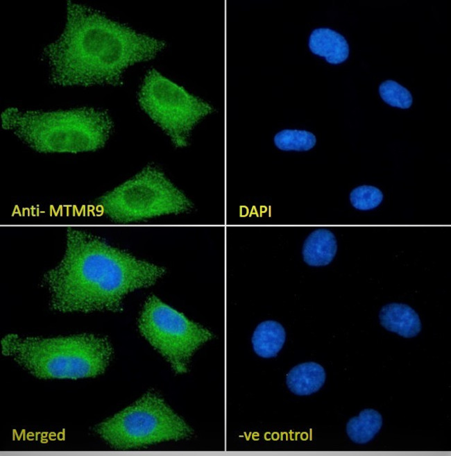 Mtmr9 Antibody in Immunocytochemistry (ICC/IF)